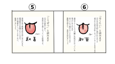 舌で知る体の状態　第４回　「紅舌」と「剥苔」